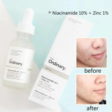 Niacinamide Serum 10% + Zinc 1% for Glowing Skin